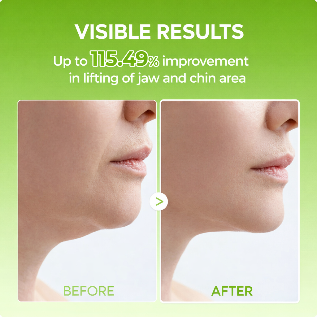 SnatchJaw® Double Chin Lifting Mask